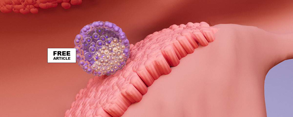 Choorosomal Pregnancy