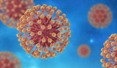 Herpes Simplex (HSV1)