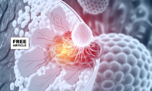 Breast Cancer and Estrogen