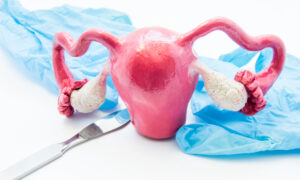 Hysterectomy