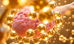 Polycystic Ovary Syndrome