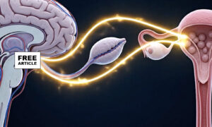 Polycystic Ovary Syndrome